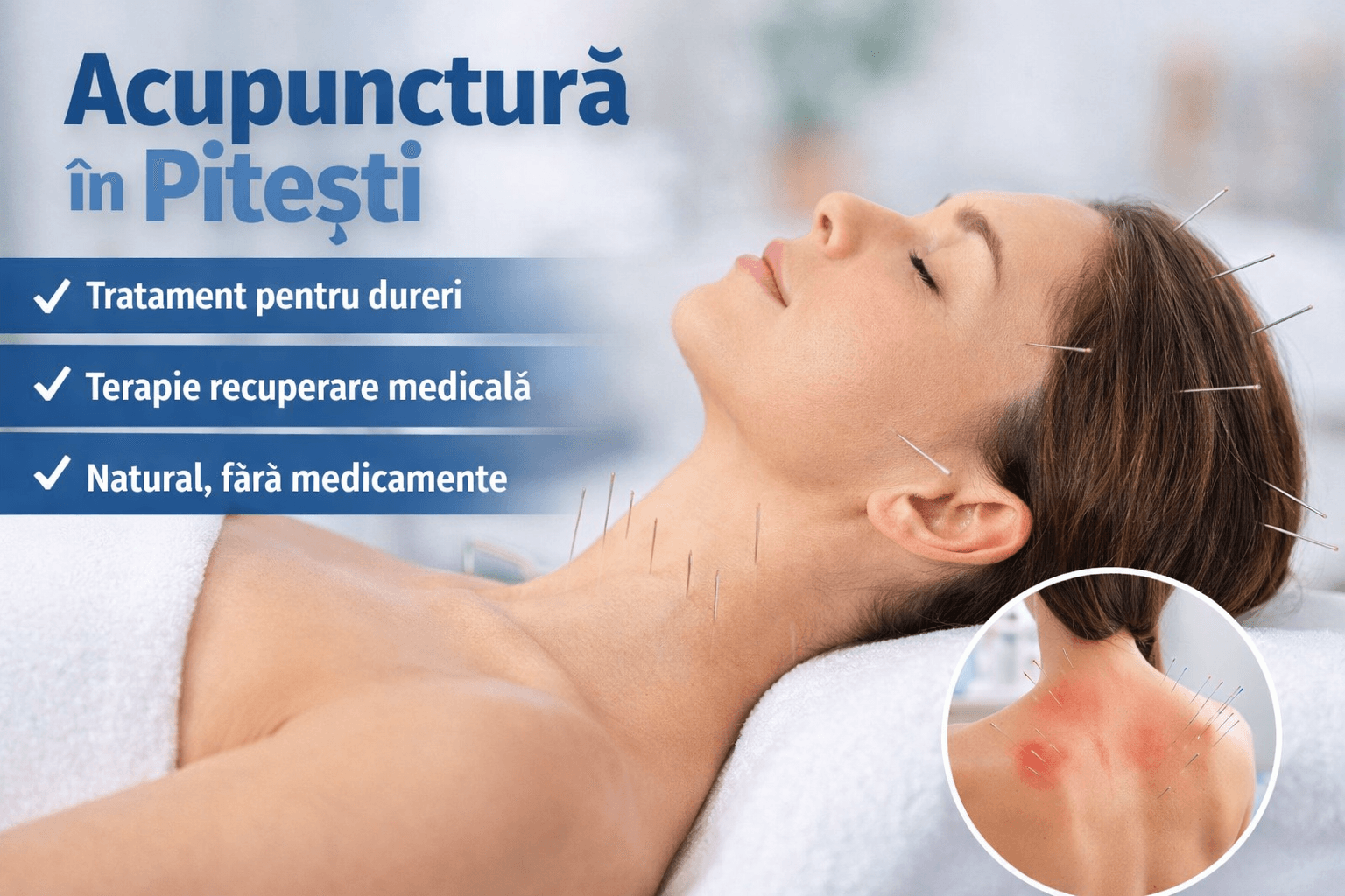 Acupunctură în Pitești pentru dureri de spate, migrene și afecțiuni cronice. Tratament natural, fără medicamente. Programare rapidă.